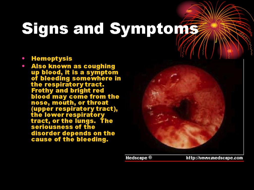 Signs and Symptoms Hemoptysis Also known as coughing up blood, it is a symptom